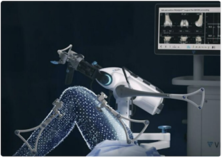 Robotique en chirurgie du genou