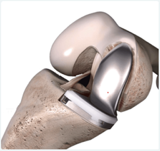 Training sur os en plastique